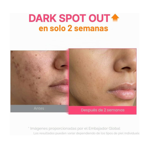Purito - Aufhellendes Serum TXA 6 Niacinamide 10 Retinal