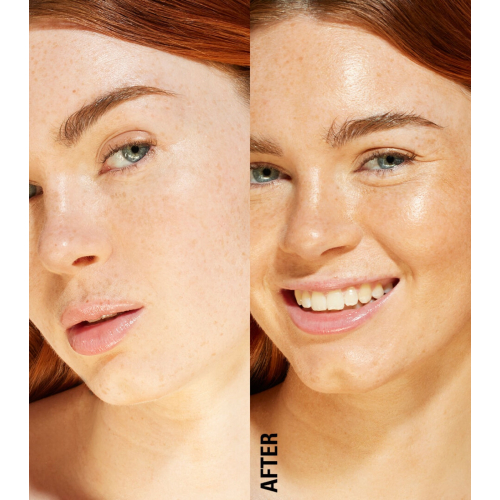 Revolution – Bräunungstropfen Bright Light - Scorched Light/ Med