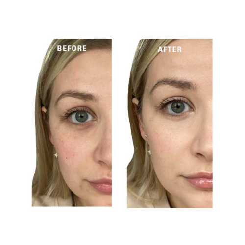 Revolution  – Cremefarbener Primer Superbase Colour Correcting - Yellow