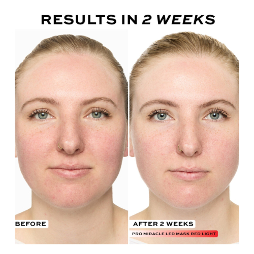 Revolution Pro - Gesichtsmaske Miracle LED Face Mask