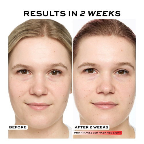 Revolution Pro - Gesichtsmaske Miracle LED Face Mask