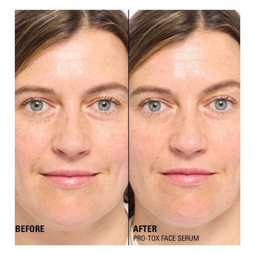 Revolution Pro - *Miracle Pro-Tox* - Reparierendes und faltenauffüllendes Gesichtsserum