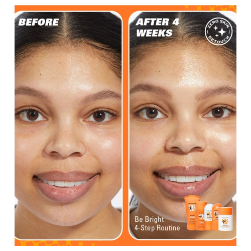 Revolution Skin - *Be Bright* - Aufhellendes Gesichtsserum mit 3 % Vitamin C Brighten Up