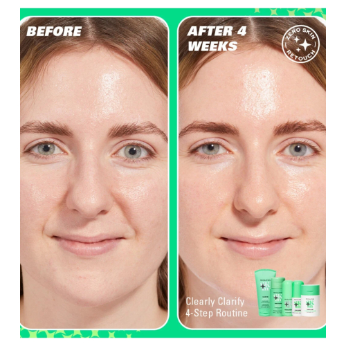 Revolution Skin - *Clearly Clarify* - Klärendes Gesichtsserum 5 % Niacinamid und 2 % Salicylsäure Clear Canvas