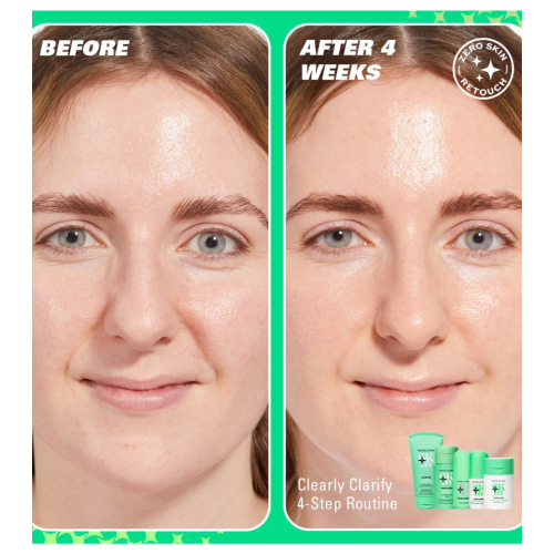 Revolution Skin - *Clearly Clarify* - Klärendes Gesichtsserum 10 % Niacinamid Serum Supreme