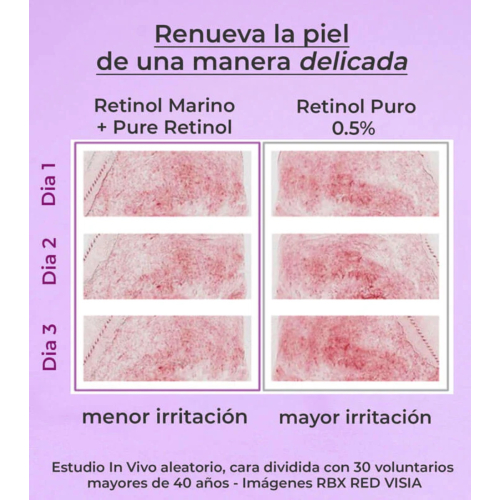 SEGLE – Anti-Aging- und straffende Routine-Packung BeSKIN von @befarmacos – Alle Hauttypen außer empfindlicher Haut