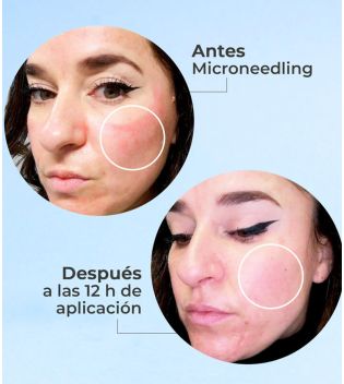 SEGLE – Regenerierendes Anti-Aging-Gesichtsserum Skin Factor – Empfindliche Haut