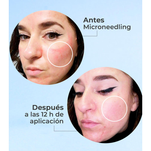 SEGLE – Regenerierendes Anti-Aging-Gesichtsserum Skin Factor – Empfindliche Haut