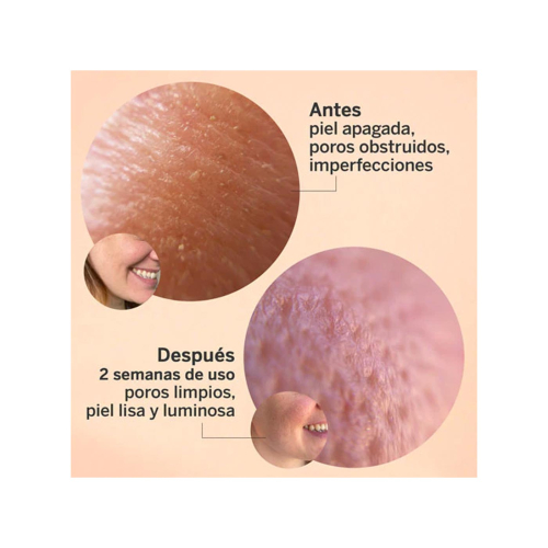 SEGLE - Glycolmix Glykolsäure-Peeling-Gesichtsserum