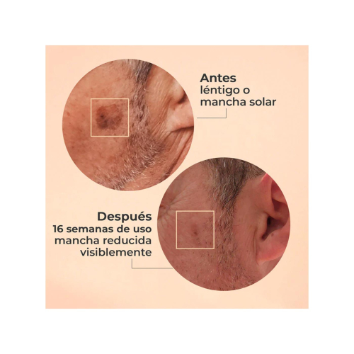 SEGLE - Glycolmix Glykolsäure-Peeling-Gesichtsserum