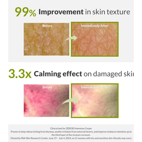 Zeroid - Intensive Reparaturcreme